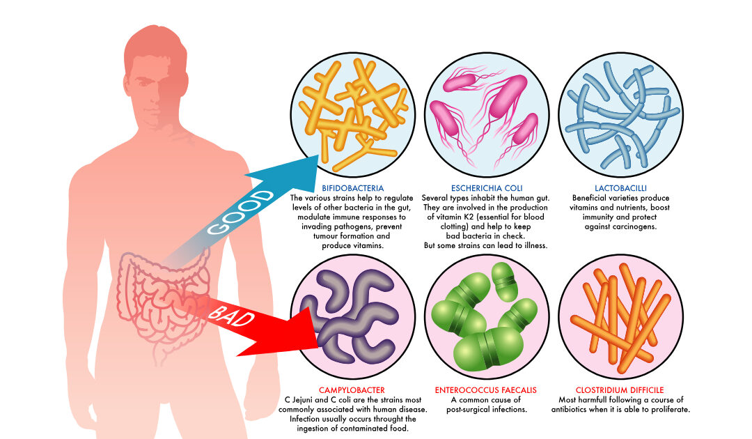 Good Bad Gut Health